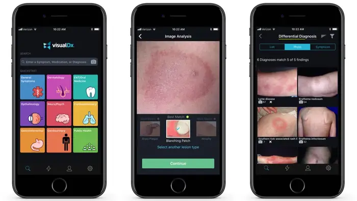 VisualDx visual diagnosis app showing skin condition image matching interface